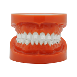 Cheap ceramic bracket (Tasuta kohaletoimetamine Eestisse) Cheap ceramic bracket (Tasuta kohaletoimetamine Eestisse)