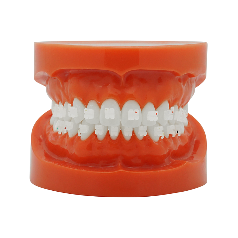 Cheap ceramic bracket (Tasuta kohaletoimetamine Eestisse) Cheap ceramic bracket (Tasuta kohaletoimetamine Eestisse)