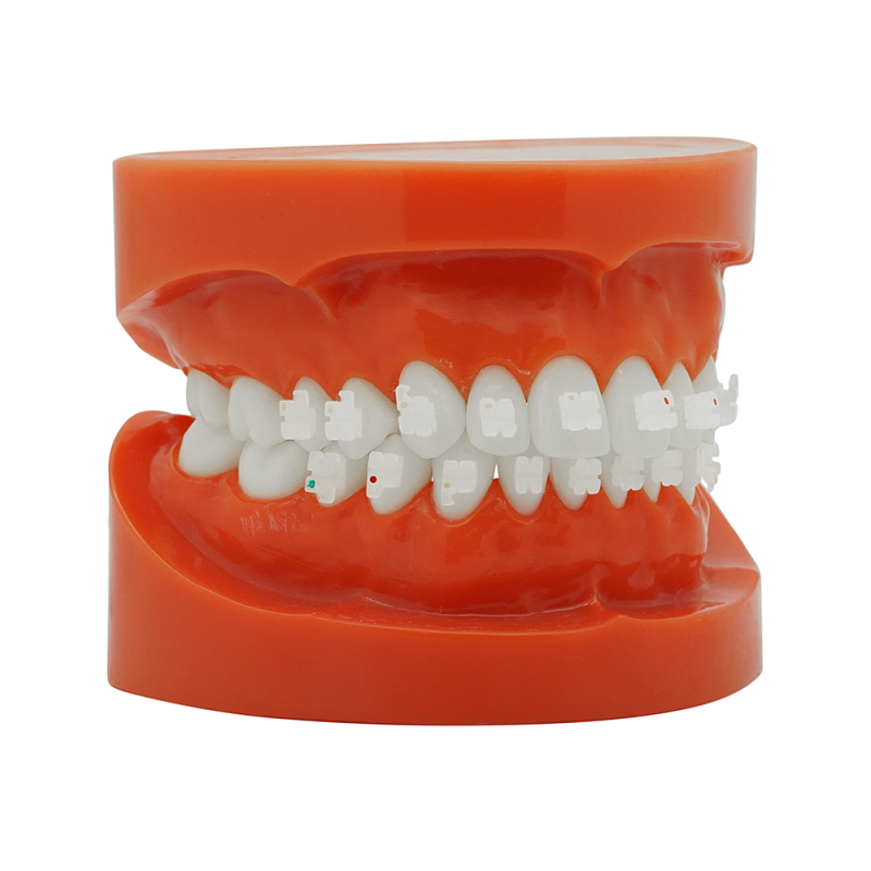 Cheap ceramic bracket (Tasuta kohaletoimetamine Eestisse) Cheap ceramic bracket (Tasuta kohaletoimetamine Eestisse)