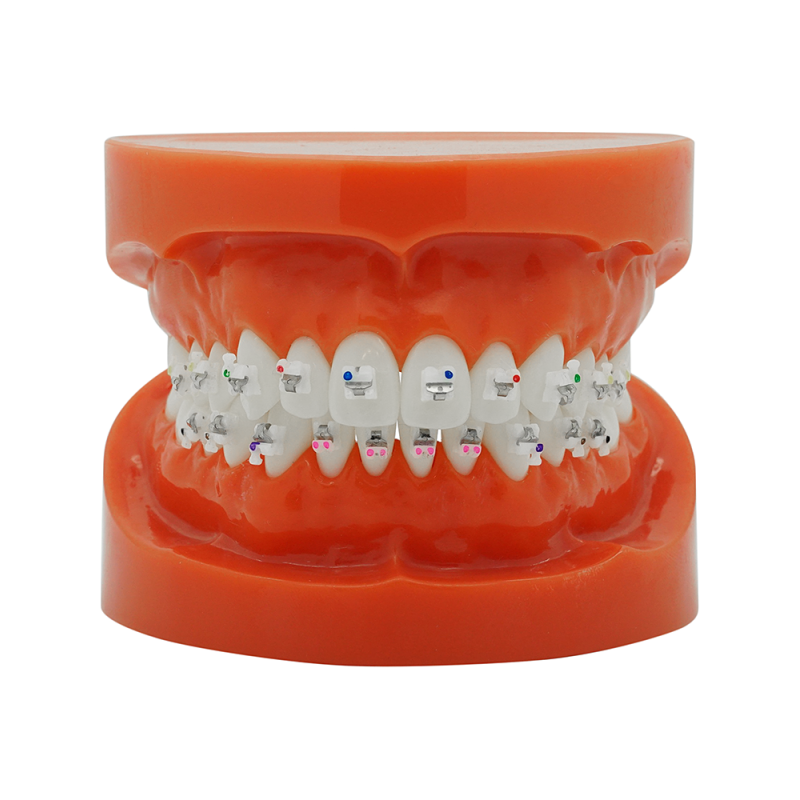 Self-ligating ceramic bracket (Brezplačna dostava v Slovenijo) Self-ligating ceramic bracket (Brezplačna dostava v Slovenijo)