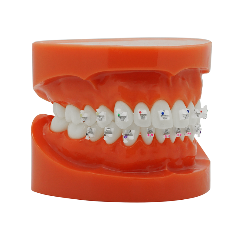 Self-ligating ceramic bracket (Brezplačna dostava v Slovenijo) Self-ligating ceramic bracket (Brezplačna dostava v Slovenijo)