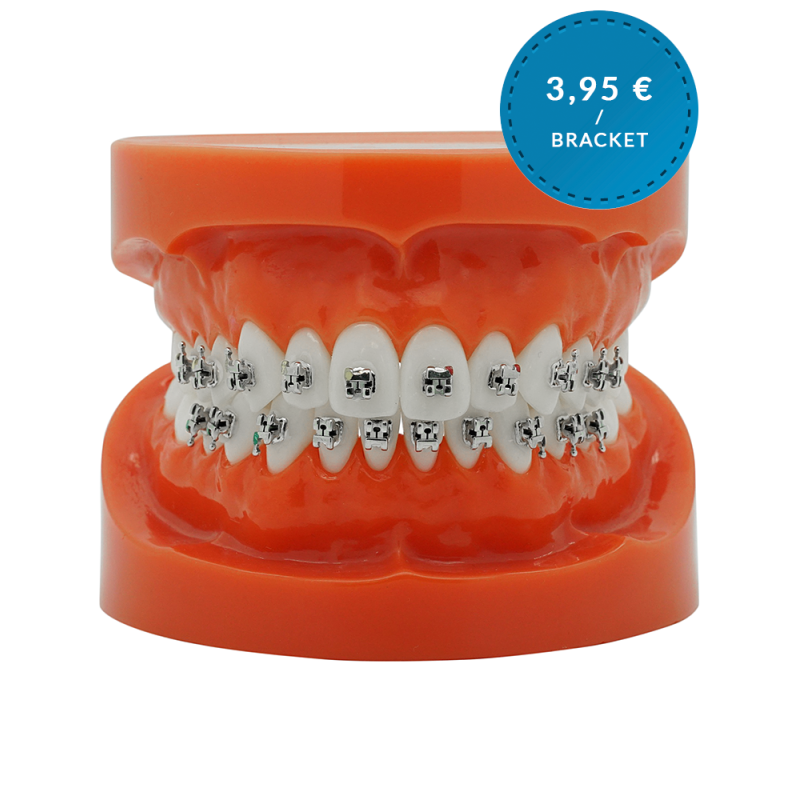 Self-ligating metal bracket (FREE UK Shipping)