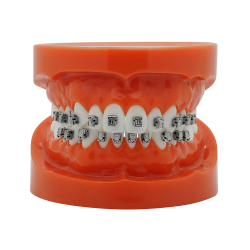 Smart Slide Self-ligating metal bracket (Doprava zdarma do České republiky) Smart Slide Self-ligating metal bracket (Doprava zdarma do České republiky)