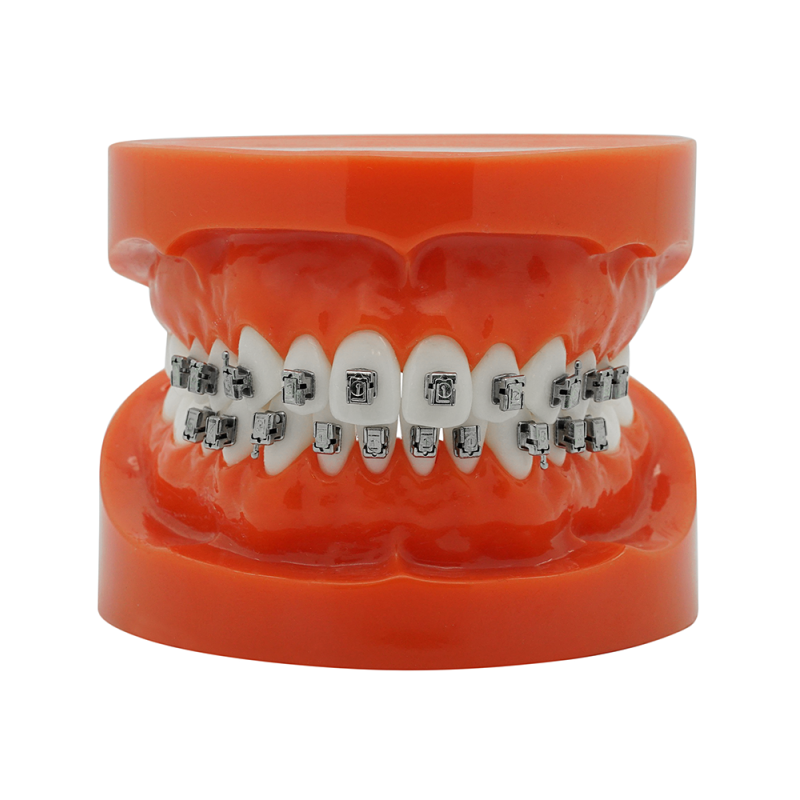 Smart Slide Self-ligating metal bracket (Doprava zdarma do České republiky) Smart Slide Self-ligating metal bracket (Doprava zdarma do České republiky)