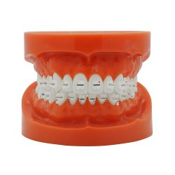 Ceramic bracket with metal slot (Livraison gratuite en France) Ceramic bracket with metal slot (Livraison gratuite en France)