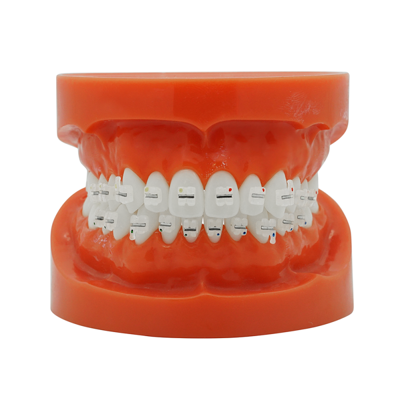 Ceramic bracket with metal slot (Livraison gratuite en France) Ceramic bracket with metal slot (Livraison gratuite en France)