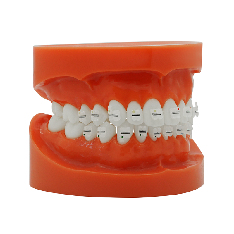 Ceramic bracket with metal slot (Livraison gratuite en France) Ceramic bracket with metal slot (Livraison gratuite en France)