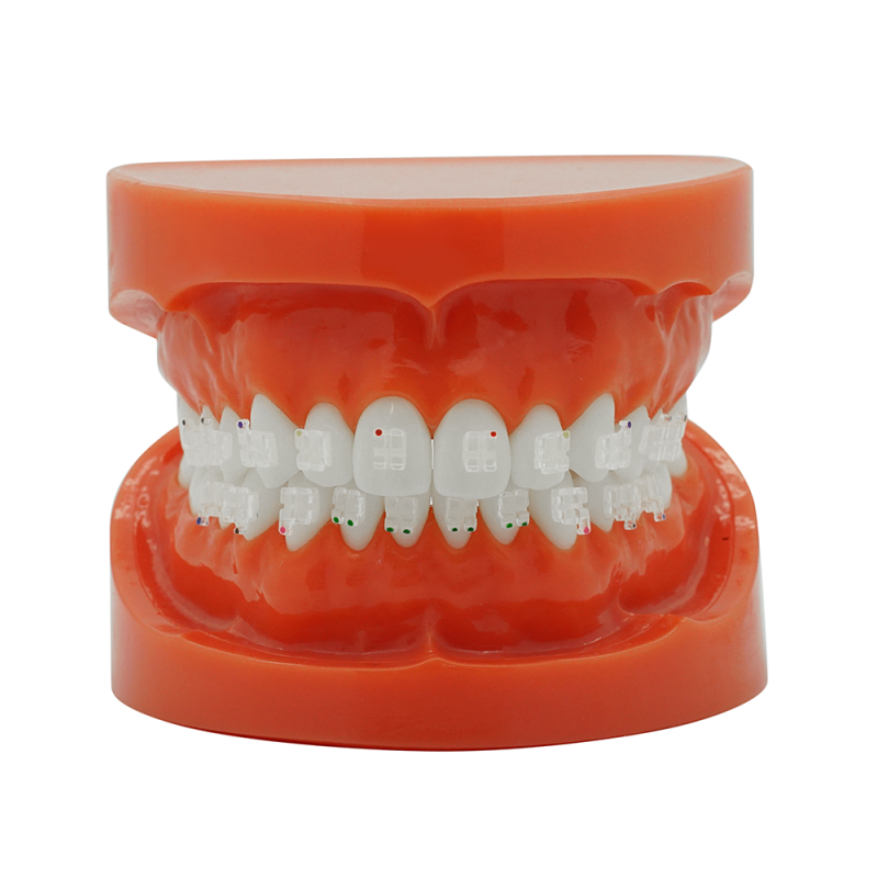 Ultra clear sapphire bracket (Doprava zdarma do České republiky) Ultra clear sapphire bracket (Doprava zdarma do České republiky)