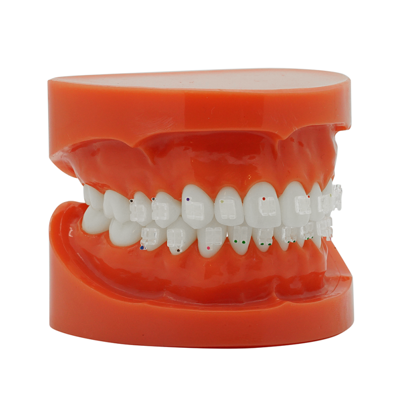 Ultra clear sapphire bracket (Doprava zdarma do České republiky) Ultra clear sapphire bracket (Doprava zdarma do České republiky)