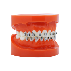 Smart Slide Self-ligating metal bracket (Doprava zdarma do České republiky) Smart Slide Self-ligating metal bracket (Doprava zdarma do České republiky)