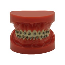 Self-ligating metal bracket (Gratis Verzending naar Nederland)