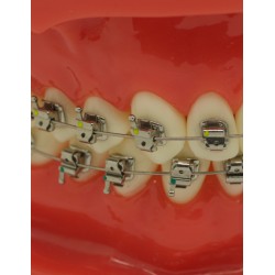 Self-ligating metal bracket (Doprava zadarmo na Slovensko)