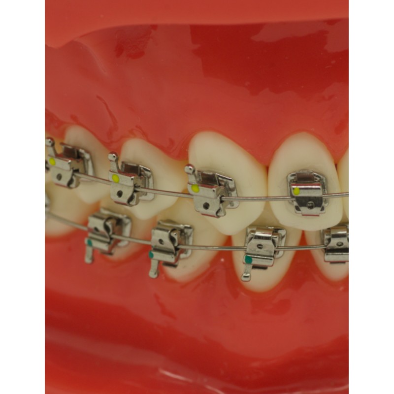 Self-ligating metal bracket (Doprava zadarmo na Slovensko)