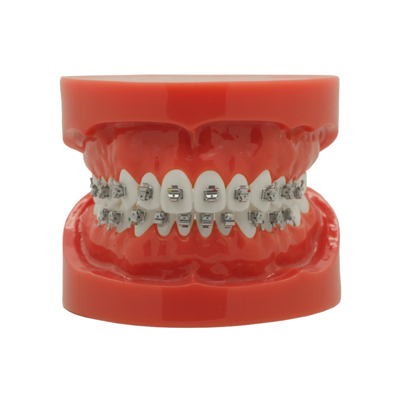 Self-ligating metal bracket (Doprava zadarmo na Slovensko)