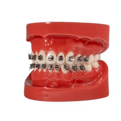 Self-ligating metal bracket (Enviament gratis a Espanya)