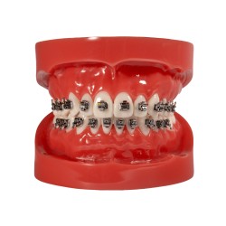 Self-ligating metal bracket (Enviament gratis a Espanya)